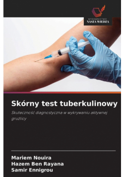 Skórny test tuberkulinowy