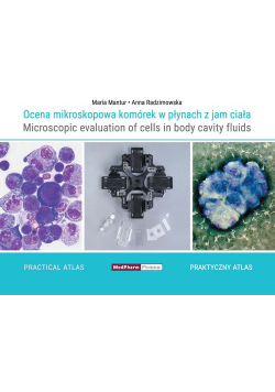 Ocena mikroskopowa komórek w płynach z jam ciała