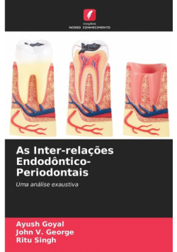 As Inter-relações Endodôntico-Periodontais