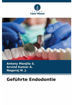 Geführte Endodontie