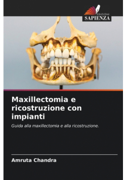 Maxillectomia e ricostruzione con impianti