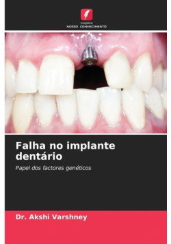 Falha no implante dentário