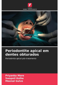 Periodontite apical em dentes obturados