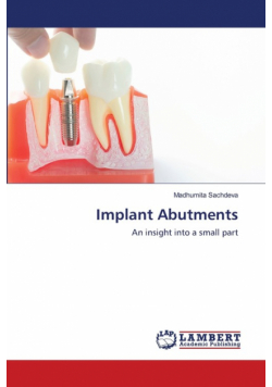 Implant Abutments