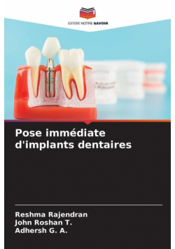 Pose immédiate d'implants dentaires