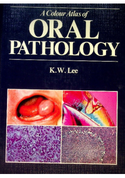 A Colour Atlas of Oral Pathology