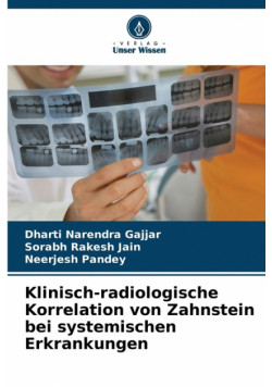Klinisch-radiologische Korrelation von Zahnstein bei systemischen Erkrankungen