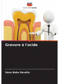 Gravure à l'acide