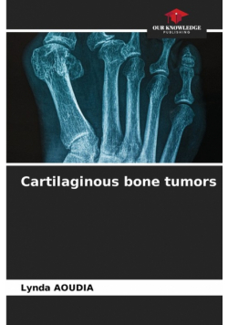 Cartilaginous bone tumors