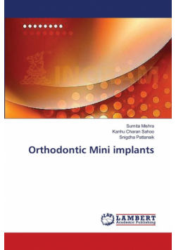 Orthodontic Mini implants