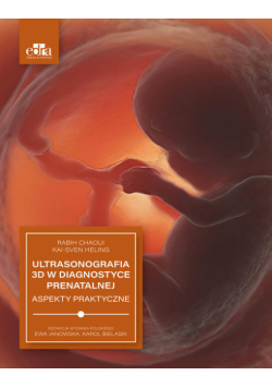 Ultrasonografia 3D w diagnostyce prenatalnej