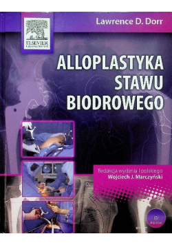 Alloplastyka stawu biodrowego