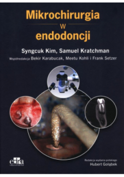 Mikrochirurgia w endodoncji