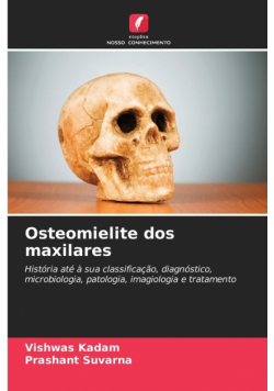 Osteomielite dos maxilares