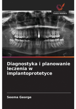 Diagnostyka i planowanie leczenia w implantoprotetyce