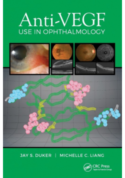 Anti-VEGF Use in Ophthalmology