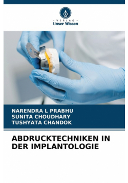 Abdrucktechniken In Der Implantologie