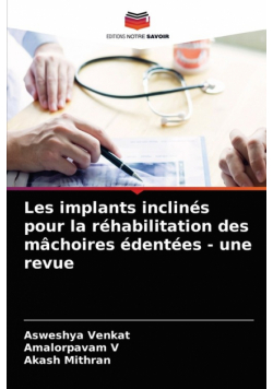 Les implants inclinés pour la réhabilitation des mâchoires édentées - une revue