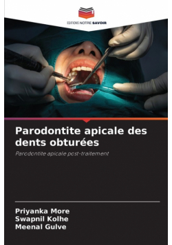 Parodontite apicale des dents obturées