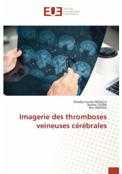 Imagerie des thromboses veineuses cérébrales