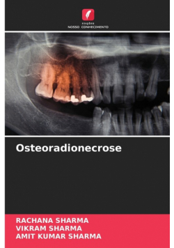 Osteoradionecrose