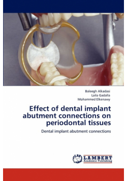 Effect of dental implant abutment connections on periodontal tissues