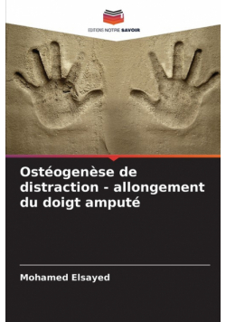 Ostéogenèse de distraction - allongement du doigt amputé