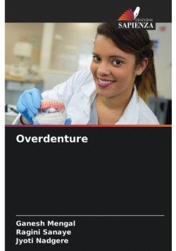 Overdenture