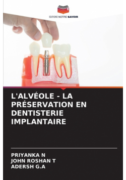 L'alvéole - La Préservation En Dentisterie Implantaire