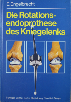 Die Rotations - endoprothese des Kniegelenks