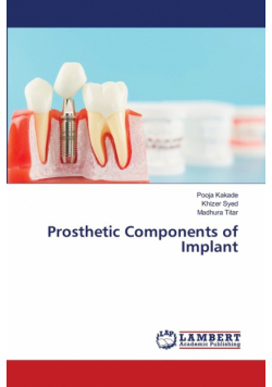 Prosthetic Components of Implant