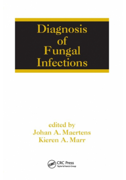 Diagnosis of Fungal Infections