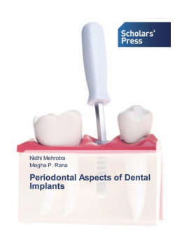 Periodontal Aspects of Dental Implants