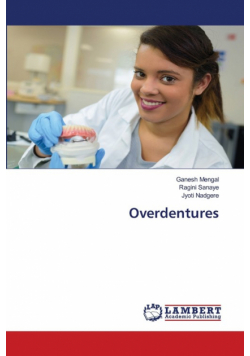 Overdentures