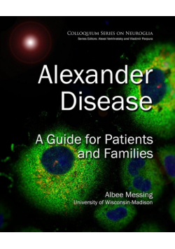 Alexander Disease