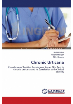 Chronic Urticaria