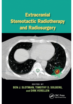 Extracranial Stereotactic Radiotherapy and Radiosurgery