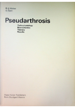 Pseudarthrosis Pathophysiology Biomechanics Therapy Results