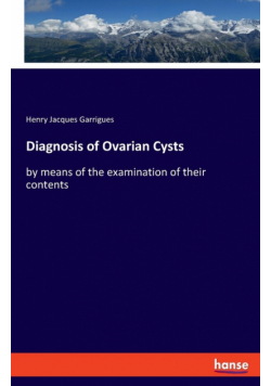 Diagnosis of Ovarian Cysts