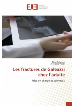 Les fractures de Galeazzi chez l'adulte