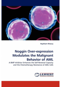 Noggin Over-Expression Modulates the Malignant Behavior of AML