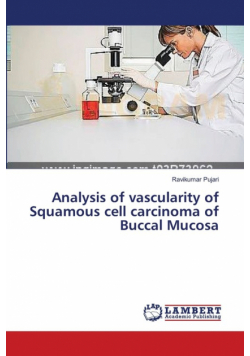 Analysis of vascularity of Squamous cell carcinoma of Buccal Mucosa