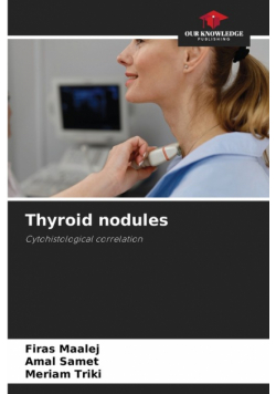 Thyroid nodules
