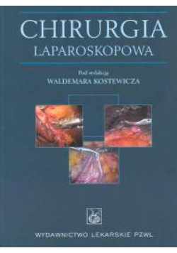 Chirurgia laparoskopowa