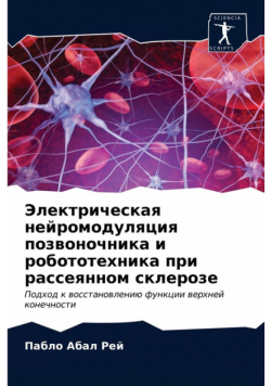Электрическая нейромодуляция позвоночника и робототехника при рассеянном склерозе
