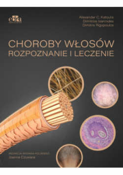 Choroby włosów. Rozpoznanie i leczenie