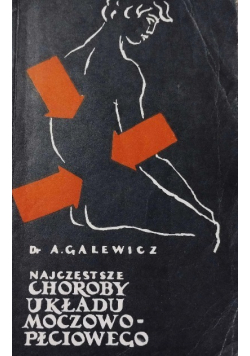 Najczęstsze choroby układu moczowo - płciowego