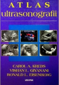 Atlas ultrasonografii