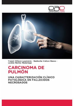 Carcinoma De Pulmón