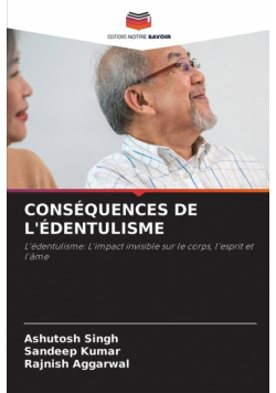 Conséquences De L'édentulisme